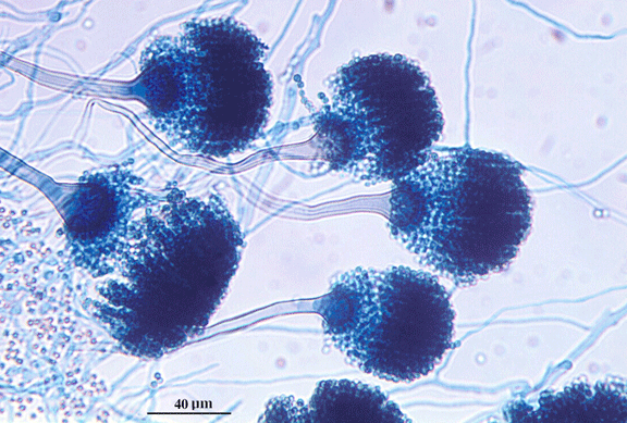 aspergillus