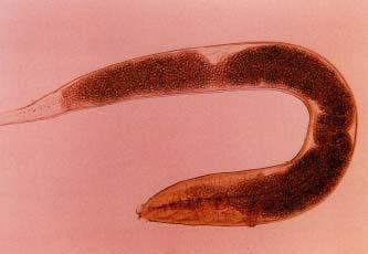enterobioza
