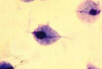 trichomonas-vaginalis
