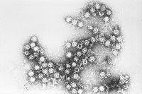 virus-coxsackie