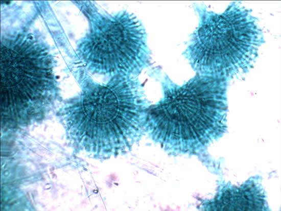 aspergilus-aspergili