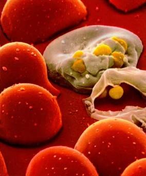 hiv-aids