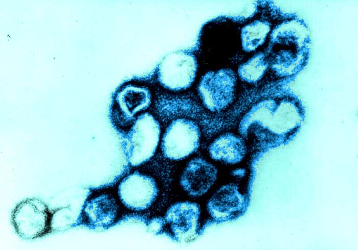 rdecke-virus-rdeck